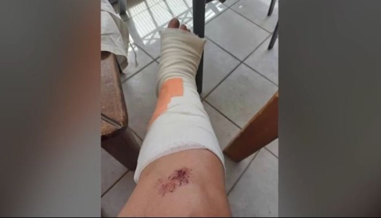 Θεσσαλονίκη: Γυναίκα τραυματίστηκε σοβαρά αφού υποχώρησε ο δρόμος